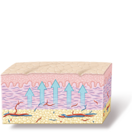 RF-ReFacing strafft in der Tiefe der Epidermis RF-ReFacing strafft in der Tiefe der Epidermis