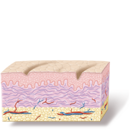 RF-ReFacing strafft in der Tiefe der Epidermis RF-ReFacing strafft in der Tiefe der Epidermis